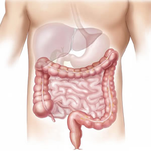 Cirugías de Sistema Digestivo